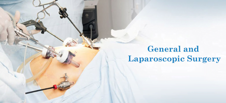 General and Laparoscopic Surgery in Varanasi | Maxwell Hospital